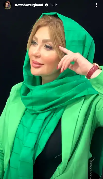 چهره بازیگر ایرانی که دیگر ناز و طبیعی نیست