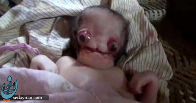 تولد ترسناک ترین نوزاد جهان