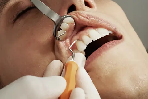 بررسی کامل مزایا و معایب ایمپلنت دندان